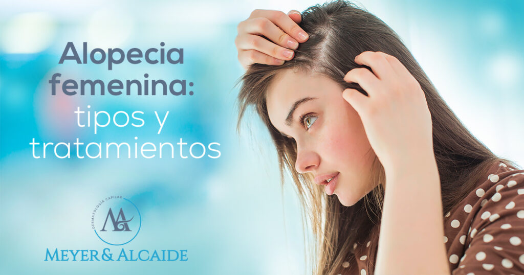 BLOG_ALOPECIA-EN-MUJERES-1200X630