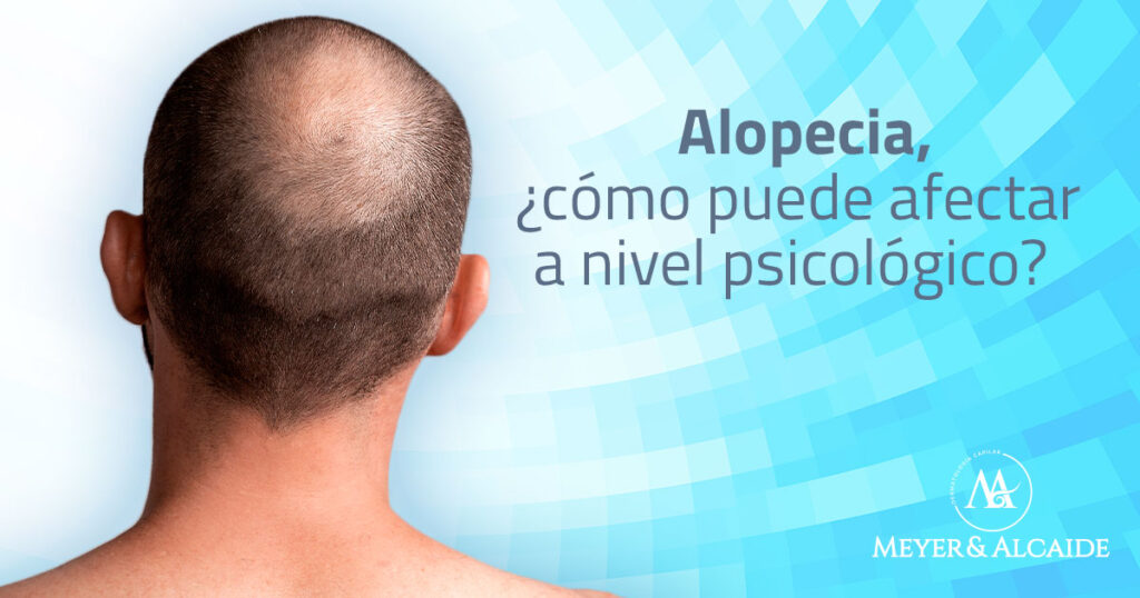 impacto-psicologico-alopecia-blog-1-100x630
