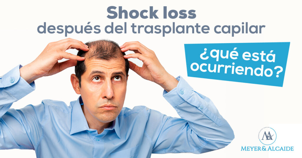 CREATIVIDAD-1BLOG-DICIEMBRE-SHOCK-LOSS-1200X630